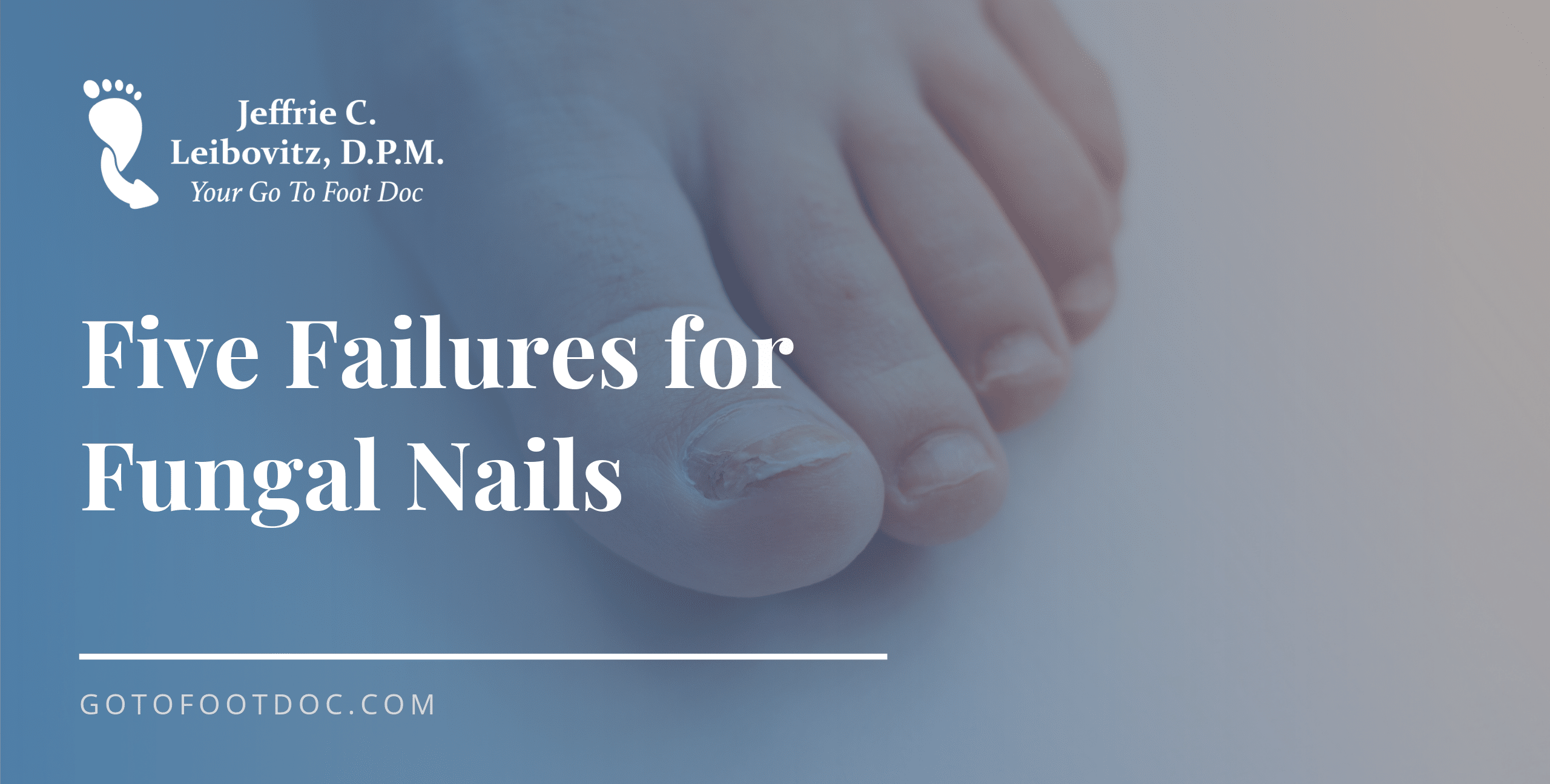 Five Failures for Fungal Nails