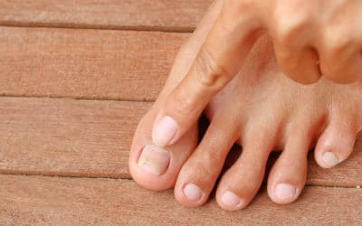 Five “Fails” for Fungal Nails