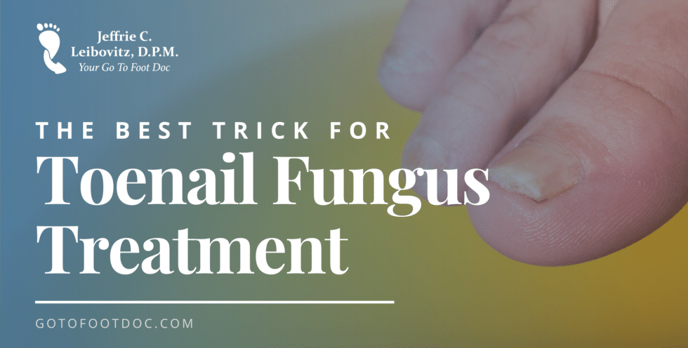 Fungal nail Graphic