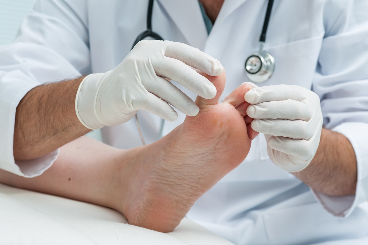 What Does a Toe Look Like After a Fungal Nail is Removed? Jeffrie C